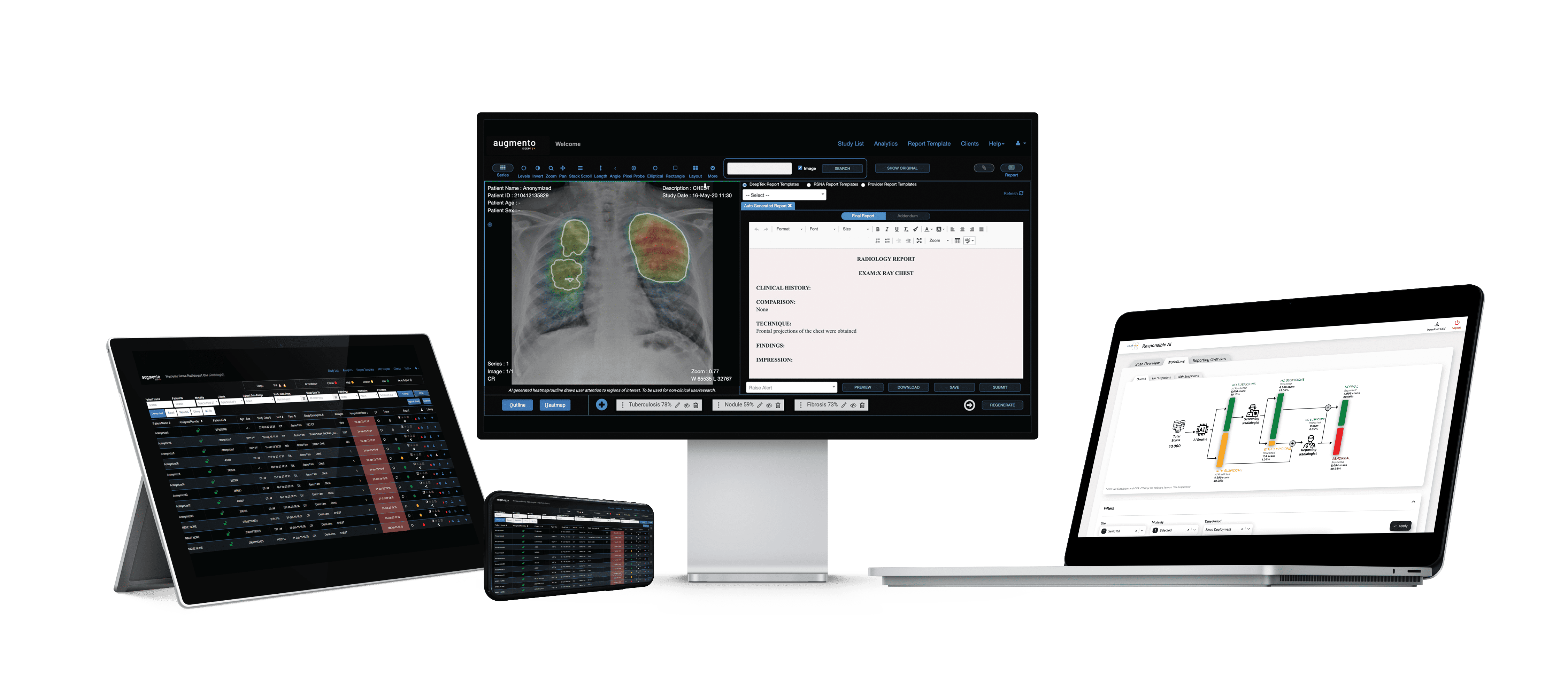 Augmento Cloud PACS powered by AI and Structured Reporting